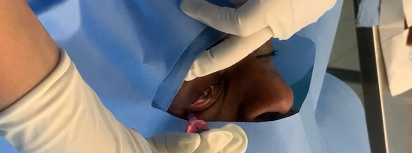 Stem Cell Therapy for Eye India