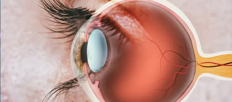 vision loss treatment=