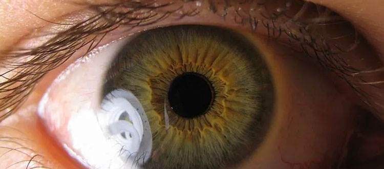 stem-cell therapy for eye