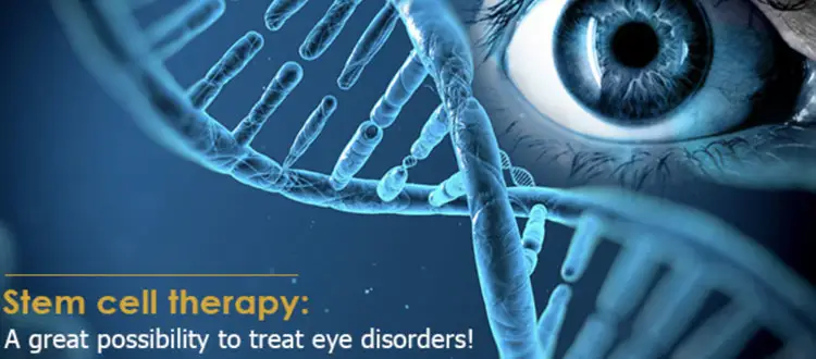 stem cell treatment