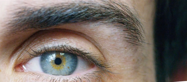 optic nerve dystrophy