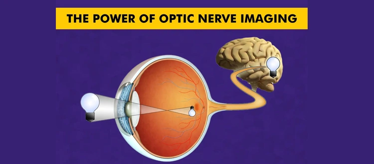 optic nerve