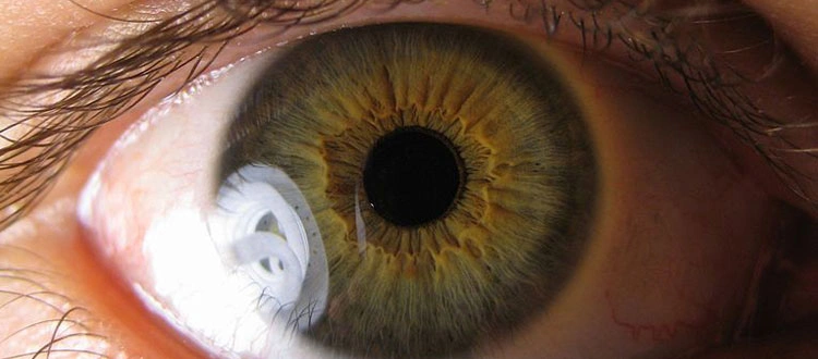 stem cell