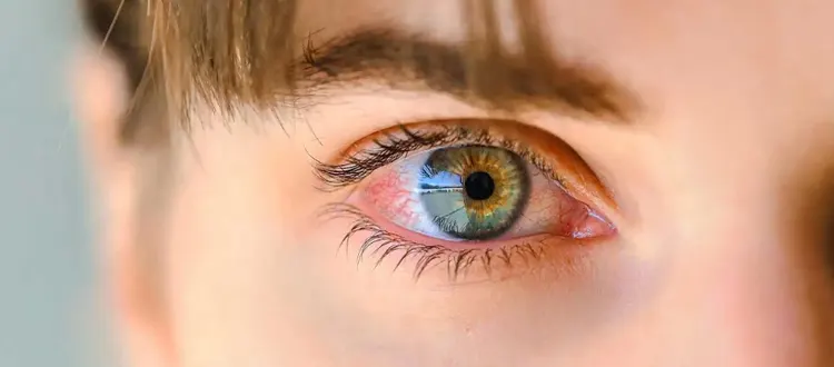 EYE